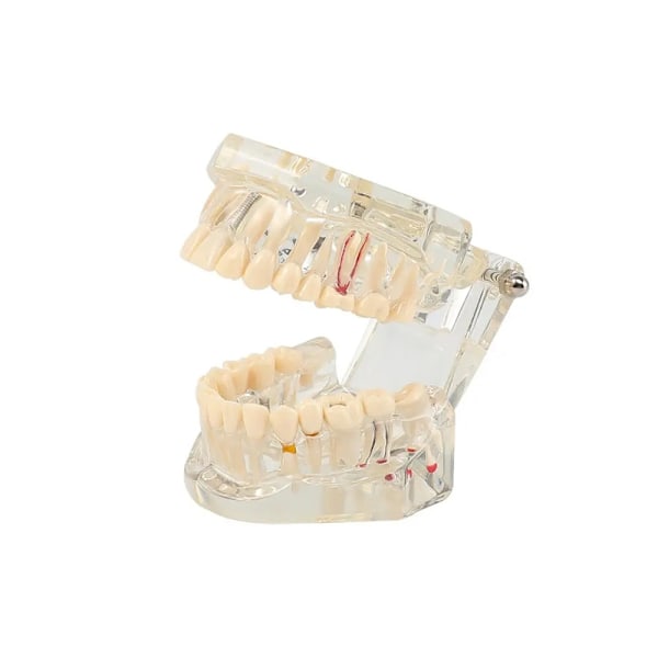Anatomisk Tandmodell - Tandprotes White