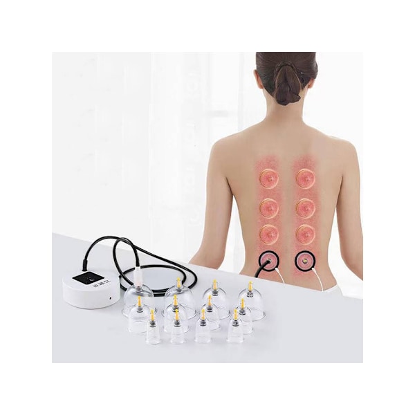 16-Pack - Koppning Set med Elektrisk Pump - Cupping Massage