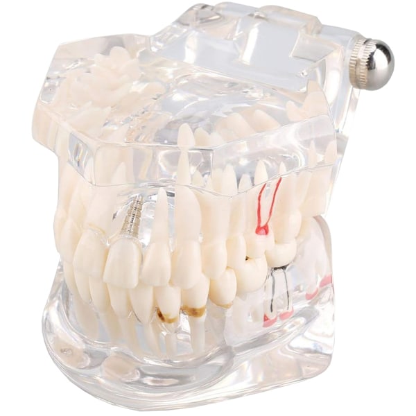 Anatomisk Tandmodell - Tandprotes Vit