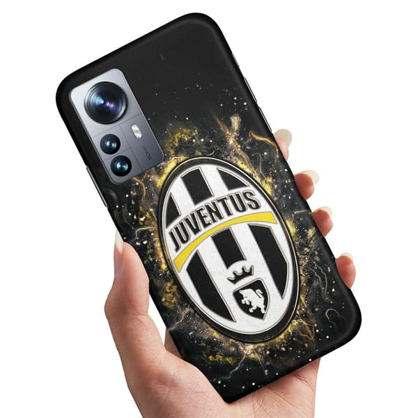 Deksel / Mobildeksel til Xiaomi 12 - Juventus