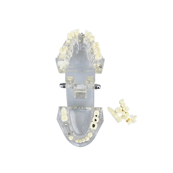 Anatomisk Tandmodell - Tandprotes White