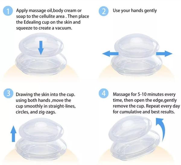 3-Pak - Koppesæt - Koppemassage Kopper - Cupping Transparent