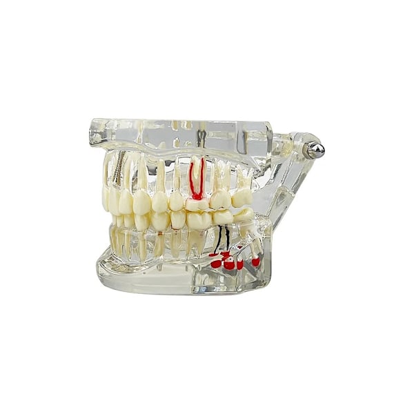 Anatomisk Tandmodell - Tandprotes White