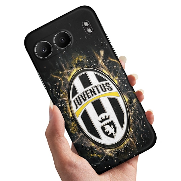 OnePlus Nord 4 - Deksel/Mobildeksel Juventus