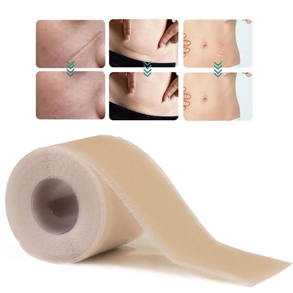 Silikonetape / Plaster til Ar – Behandling af ar
