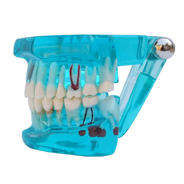 Anatomisk Tandmodell - Tandprotes Blue