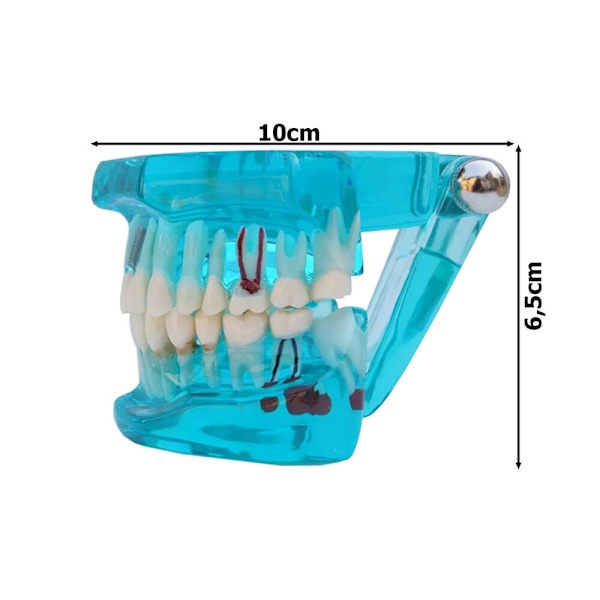 Anatomisk Tandmodell - Tandprotes Blue