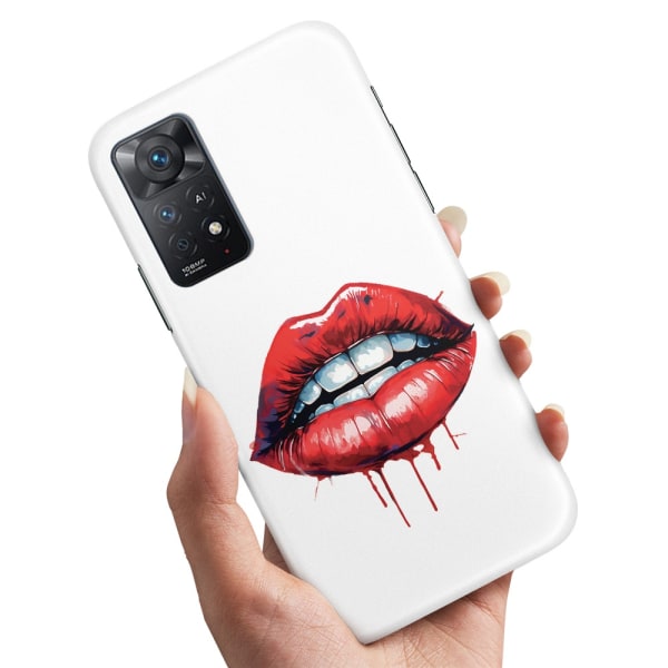 Xiaomi Redmi Note 11 - Cover/Mobilcover Lips