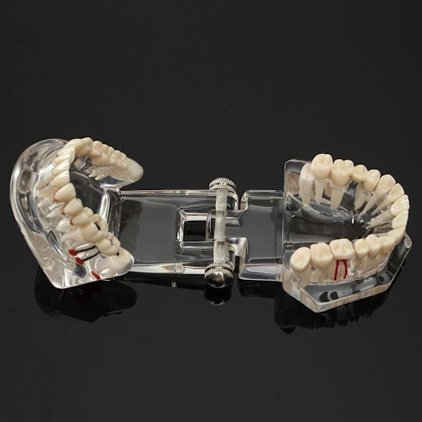 Anatomisk Tandmodell - Tandprotes White