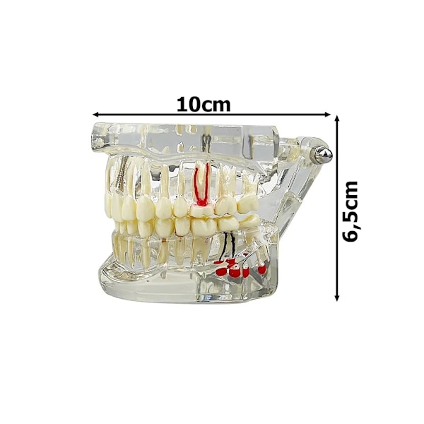 Anatomisk Tandmodell - Tandprotes White