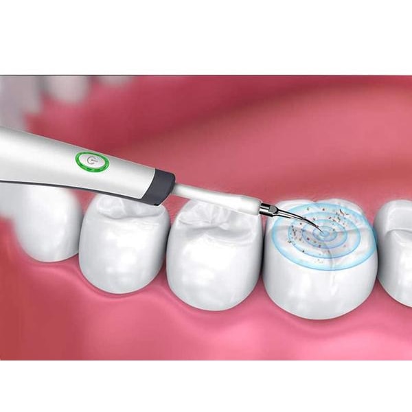 2-i-1 Tandpolerare & Verktyg för borttagning av tandsten Svart