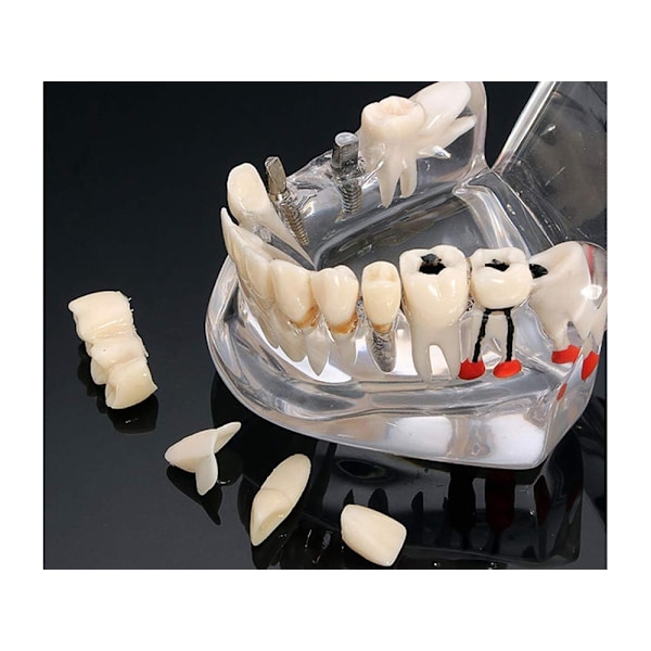 Anatomisk Tandmodell - Tandprotes White
