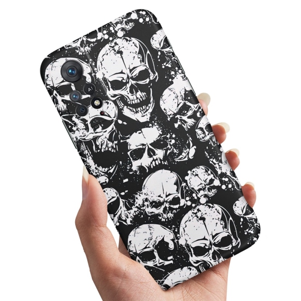 Xiaomi Redmi Note 11 Pro - Skal/Mobilskal Skulls