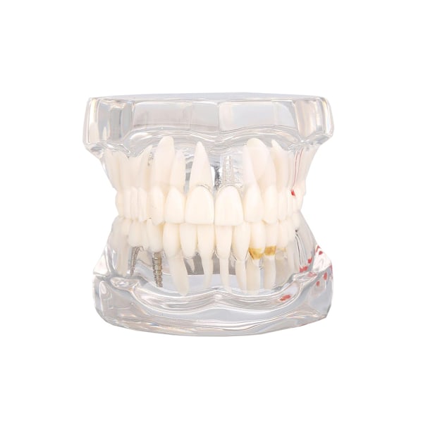 Anatomisk Tandmodell - Tandprotes White