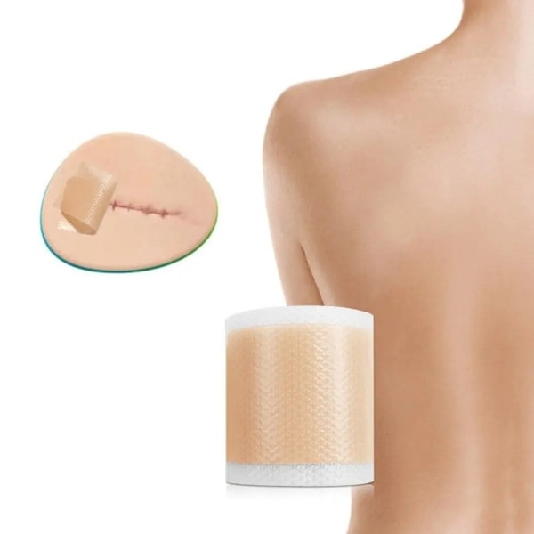 Silikonetape / Plaster til Ar – Behandling af ar