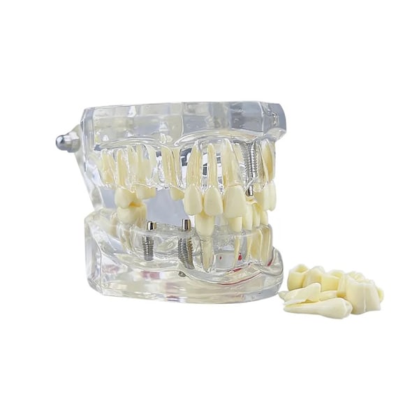 Anatomisk Tandmodell - Tandprotes Vit