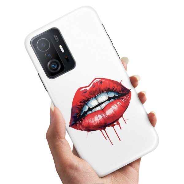 Xiaomi 11T/11T Pro 5G - Cover/Mobilcover Lips