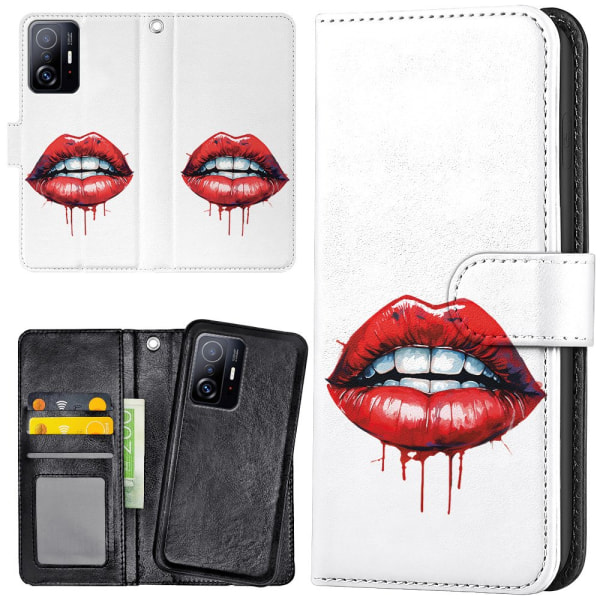 Xiaomi 11T/11T Pro - Mobilcover/Etui Cover Lips