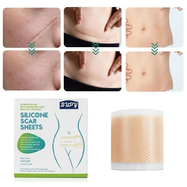 Silikonetape / Plaster til Ar – Behandling af ar
