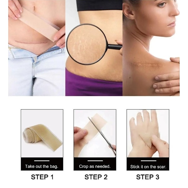 Silikontape / Plaster for Arr – Behandling av arr