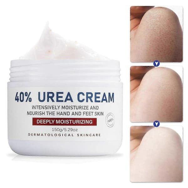 40% Urea Fodcreme til Revnede Hæle, Dybdegående Fugtgivende Hårdhudsfjerner, Behandler Tør Hud, 150g