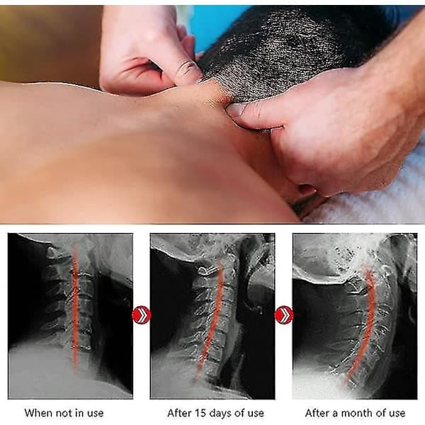 Trapezius Spark Point Massasjeverktøy, Cervical Massasje Fingerpress