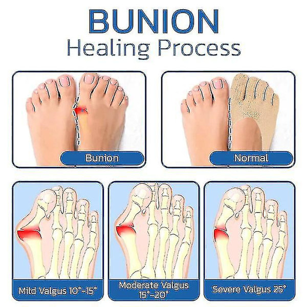 Projoint Anti Bunions Health Sock 3 väriä saatavilla Khaki