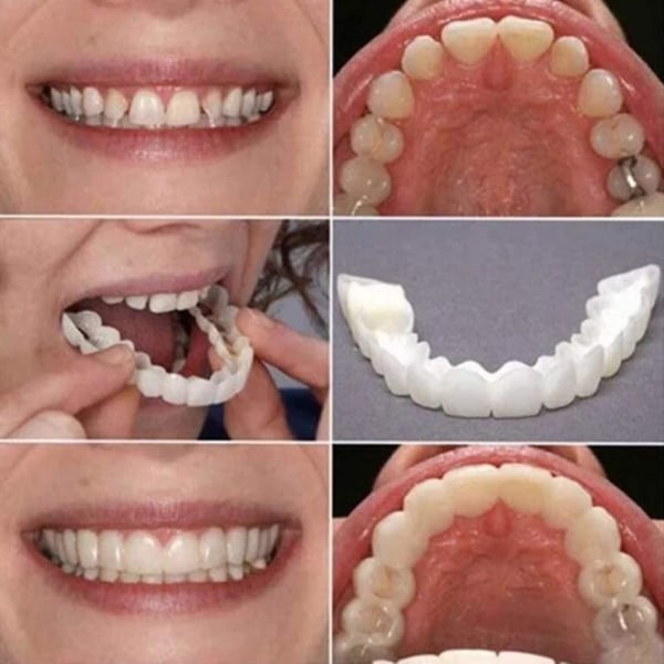 Smile Teeth Faner Fake Cosmetic Teeth Faner Instant Denture Cover Proteser för män och kvinnor 2st