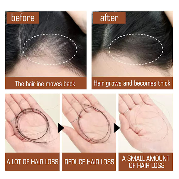 Naturlig Batanao för hårväxt - Naturlig formel som stimulerar hårrehabilitering, reparerar och återfuktar torr hårbotten, dämpar frizz ...