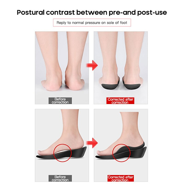 Innersula Plattfot O-formade ben Valvstöd Plantar Fasciitis vit stor white medium