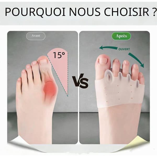 Silikone tåspreder til overlappende tæer, Hallux Valgus korrigerer til afslapning og strækning, korrigerer tæer