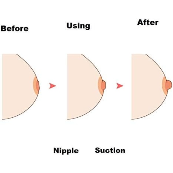 Nipplesucker Corrector for Inverted, Puller eller Extender Latch Assist E