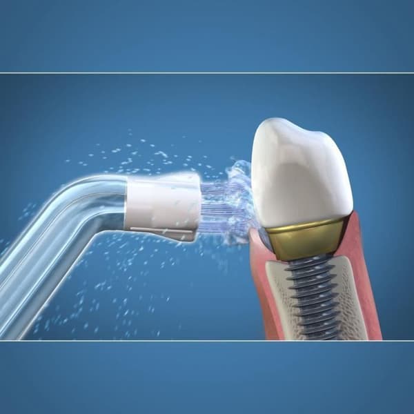 Water Flosser Tip - WATERPIK - Plaque Seeker - Eliminerar plack