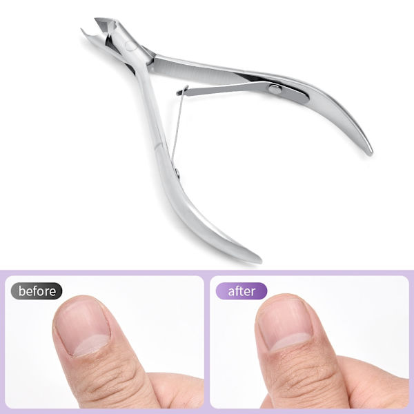 Nagelband Trimmer Professionell Nagelband Trimmer