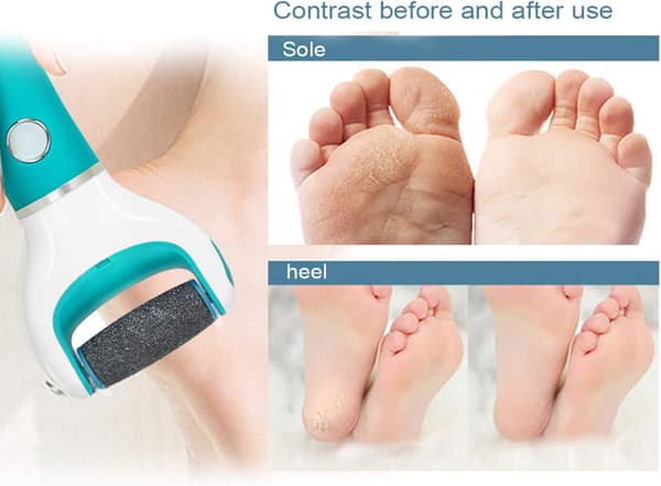 Scholl Velvet Smooth Pedi Erstatningsruller - 9-pakning
