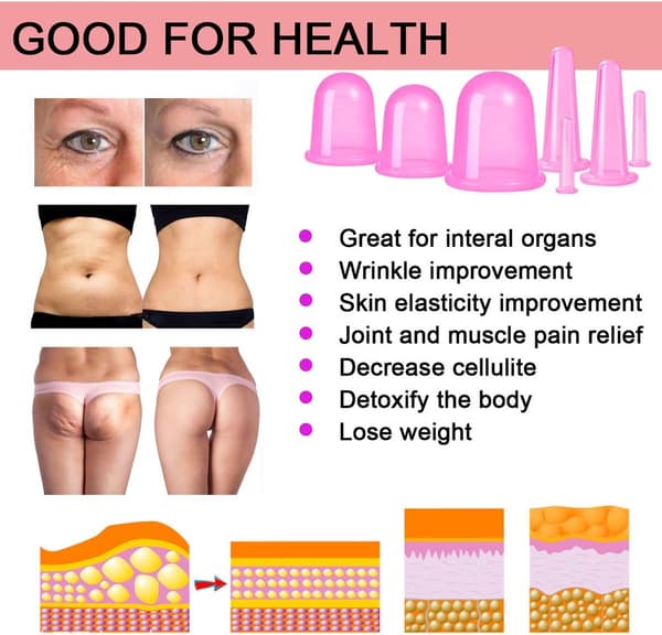 Ansiktskoppningsset, 7 delar silikon anti-cellulit vakuumkoppar, rosa
