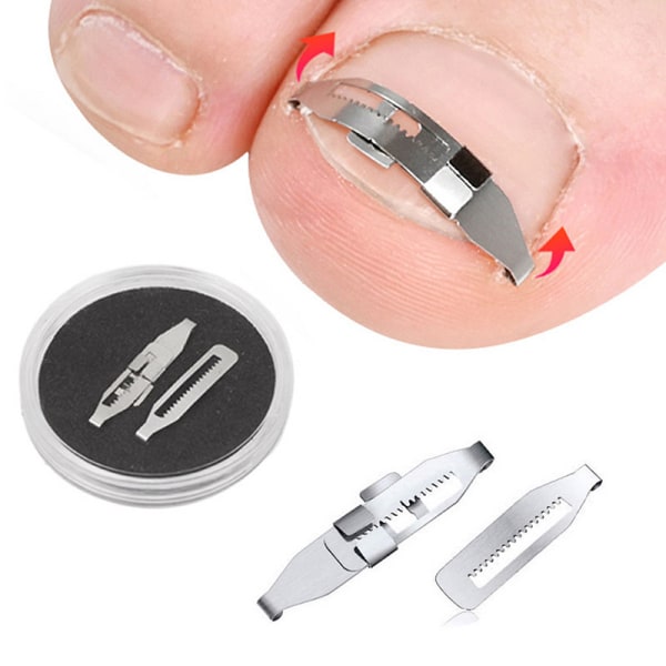 Pedicure Recover Embed Toe Nail Indgroet tånegl Corrector Treat one size