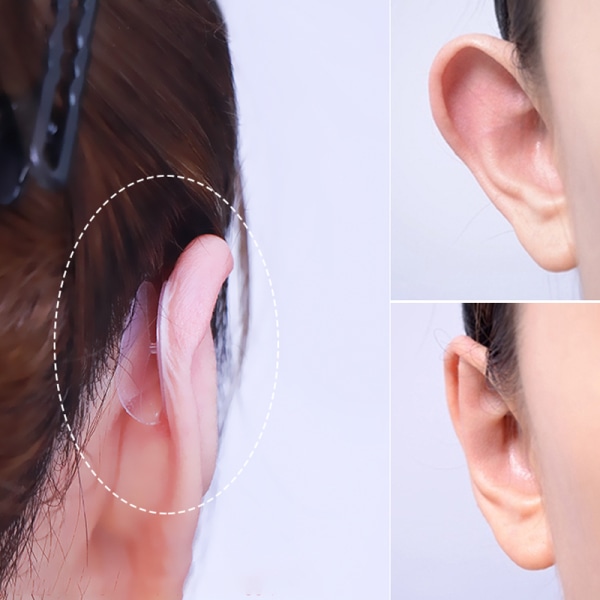 10 stk. usynlige fremspringende ører Correctar Tape Ear Aesthetic Co White