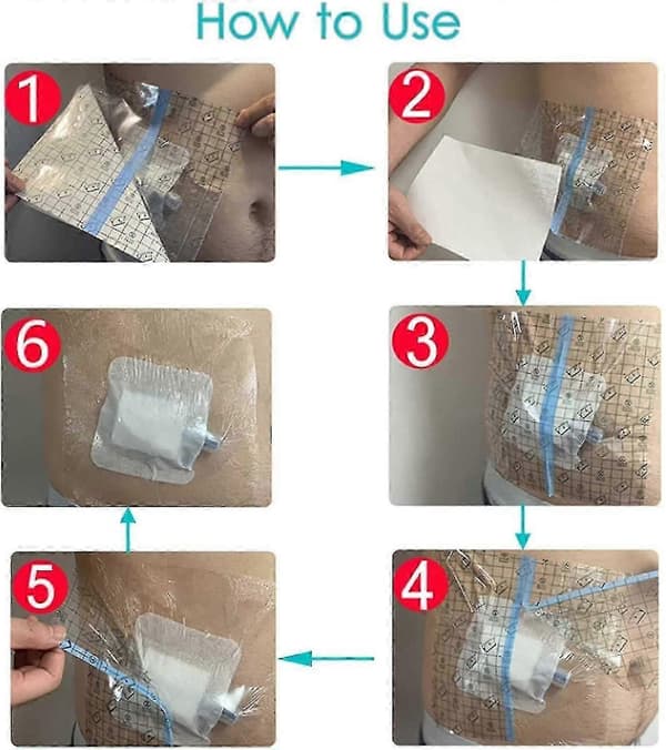 100 stk. vanntette dusjbeskyttere for brystkateter PD Peritoneal dialyse