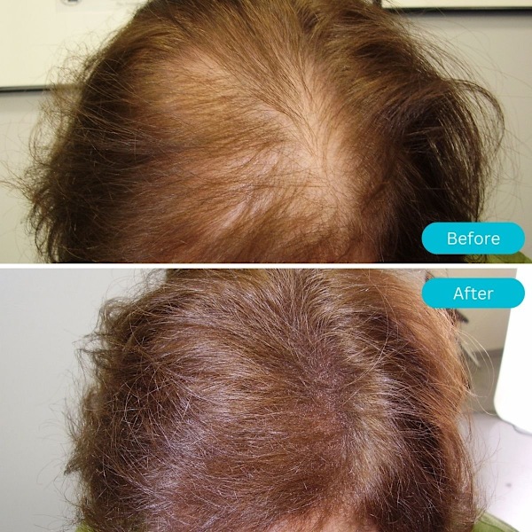 Hair Pro - Auburn / Rood