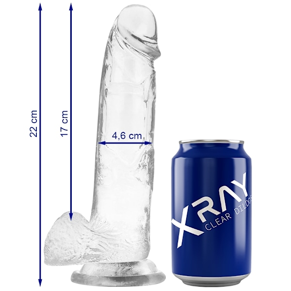 Röntgenkuva - Kirkas Hana palloilla 22 cm -O- 4,6 cm