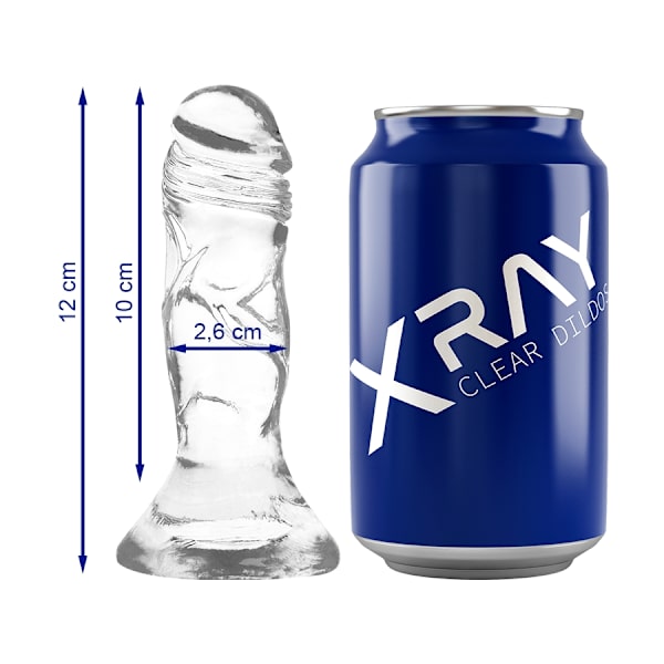 Röntgen - kirkas hana 12 cm -O- 2,6 cm