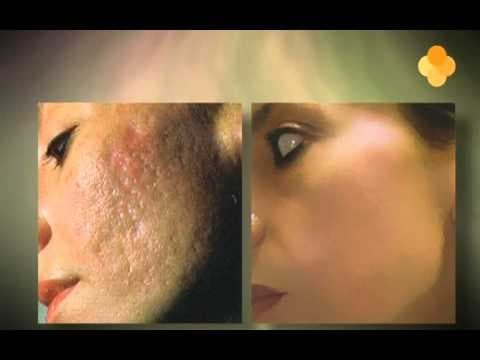 Orange Care - Baba de Caracol kräm