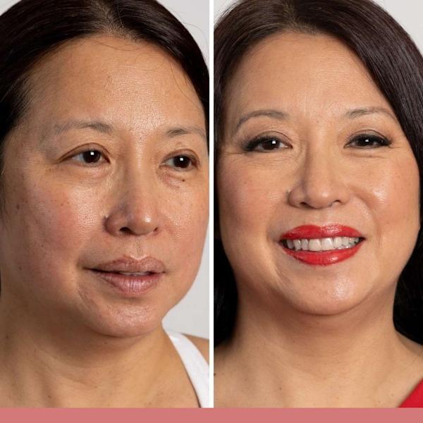 Tight Lift & Cover Undereye Solution set - Medium