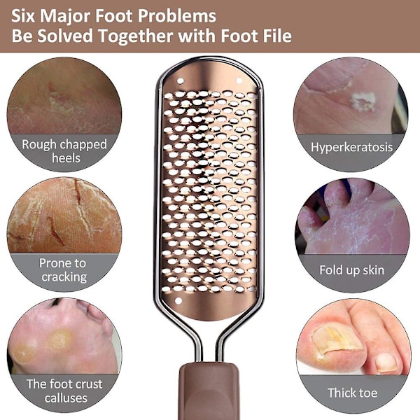 Pedicure Fodfil Hård hudfjerner - stor fodrasp Colossal Fodskrubber Professionel rustfrit stål Hård fil til våde og tørre fødder