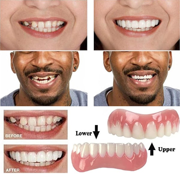 Silikonproteser, Övre och Nedre Veneers, Perfekt Leende, Veneers, Proteser, Pasta, Falska Tänder, Tandställning, Munhygienverktyg