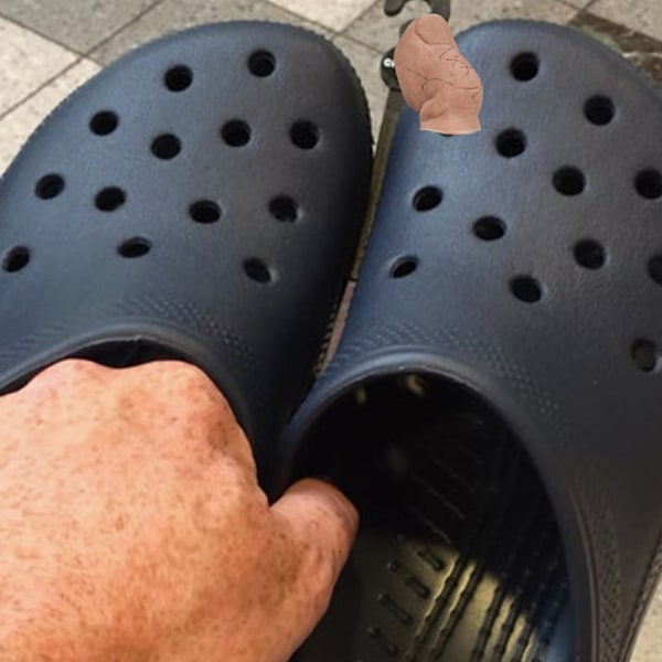 Stor Tå Croc Charm med Hår Återanvändbar Lättviktig Skodekor för Håliga Träskor Avhårad Dehaired pcs