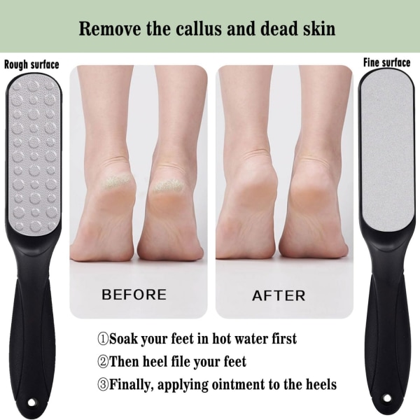 Ammattimainen Jalkojen Scrubber Callus Remover - kestävä, hygieeninen pedikyyrityökalu sileille, terveille jaloille