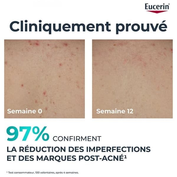 Eucerin Dermopure Kräm Kropp Triple Action 200ml