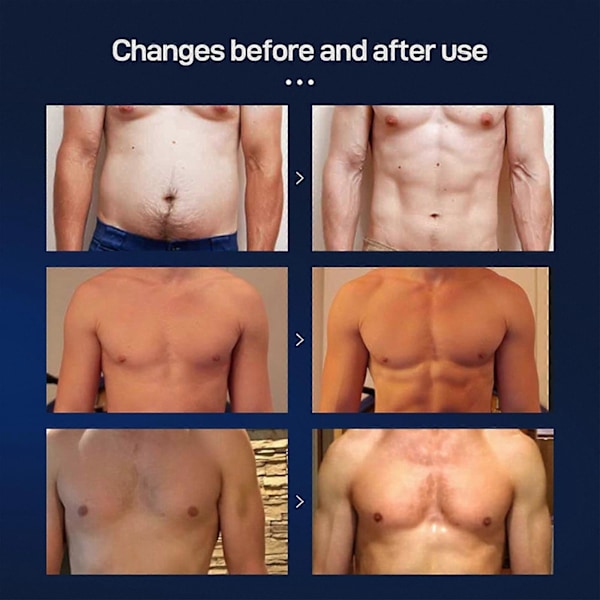 Gynækomasti Reduktionsspray, Gynækomasti Reduktions Cellulitespray, Mænd Bryst Cellulite Brænder Spray, Mænd Bryst Fedtreduktionsspray